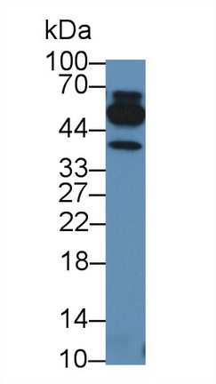 Polyclonal Antibody to Tumor Necrosis Factor Beta (TNFb)