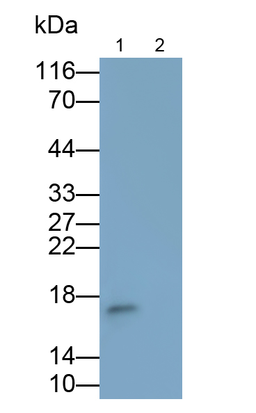 Polyclonal Antibody to Tumor Necrosis Factor Beta (TNFb)