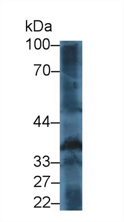 Polyclonal Antibody to Thrombopoietin (TPO)