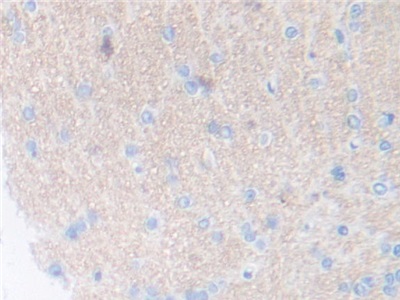 Polyclonal Antibody to Thrombopoietin (TPO)