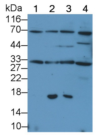 Polyclonal Antibody to Tumor Necrosis Factor Related Apoptosis Inducing Ligand (TRAIL)