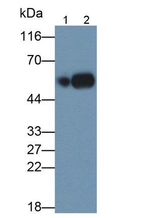 Polyclonal Antibody to Plasminogen Activator, Urokinase (uPA)