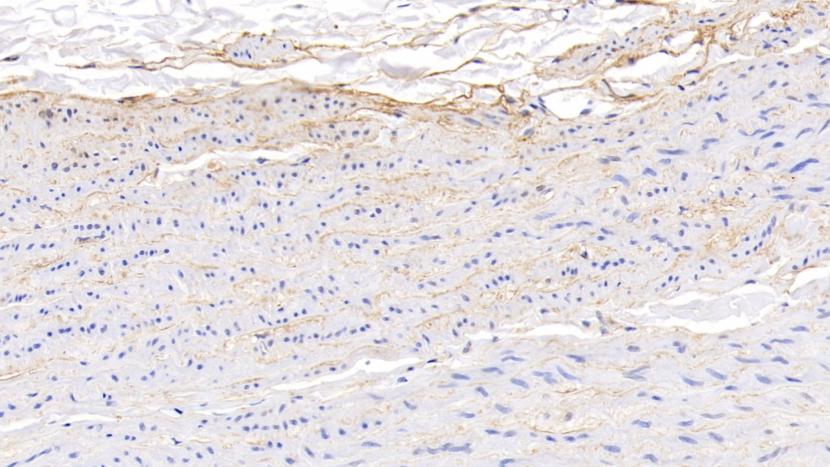 Polyclonal Antibody to Vascular Endothelial Growth Factor A (VEGFA)