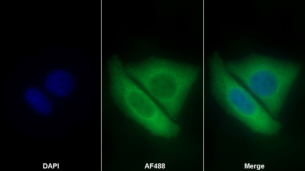 Polyclonal Antibody to Vascular Endothelial Growth Factor A (VEGFA)