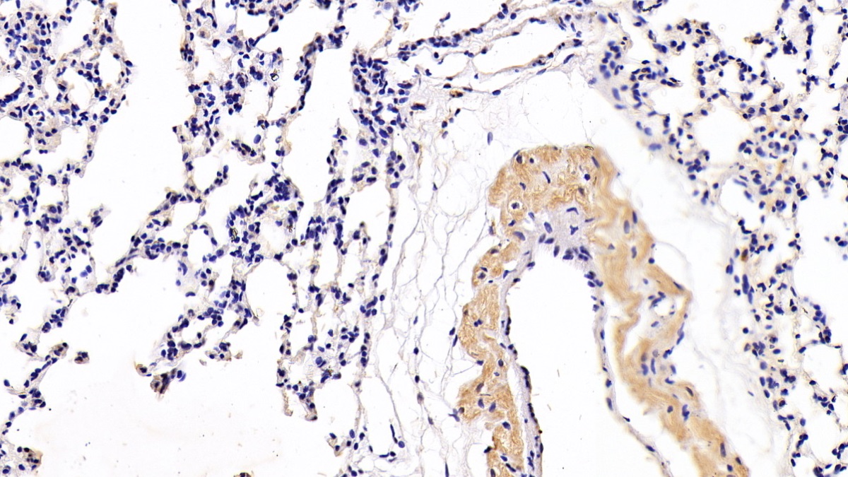 Polyclonal Antibody to Vascular Endothelial Growth Factor A (VEGFA)