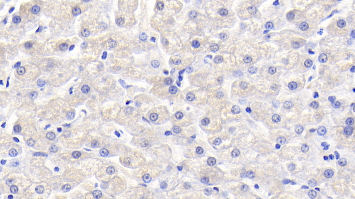 Polyclonal Antibody to Vascular Endothelial Growth Factor B (VEGFB)