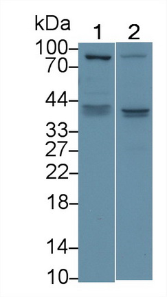 Polyclonal Antibody to Vascular Endothelial Growth Factor D (VEGFD)