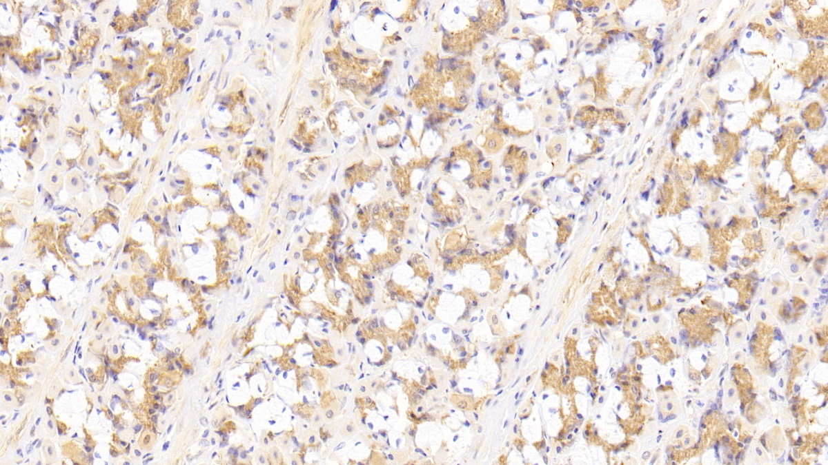 Polyclonal Antibody to Vascular Endothelial Growth Factor D (VEGFD)