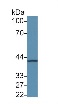 Polyclonal Antibody to Coagulation Factor VIII Associated Protein 1 (F8A1)