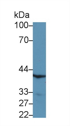 Polyclonal Antibody to Coagulation Factor VIII Associated Protein 1 (F8A1)