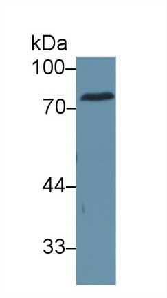 Polyclonal Antibody to Carcinoembryonic Antigen (CEA)