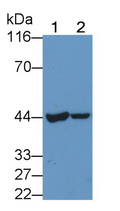 Polyclonal Antibody to Carcinoembryonic Antigen (CEA)