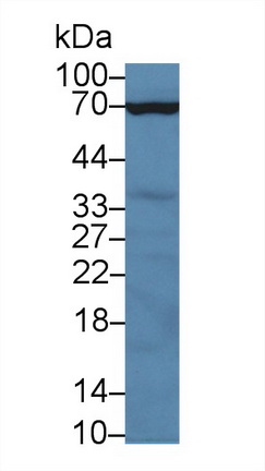 Polyclonal Antibody to Carcinoembryonic Antigen (CEA)