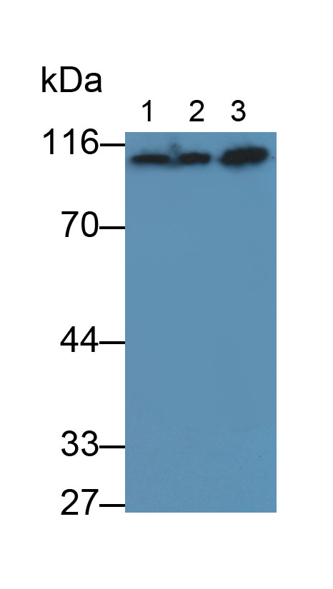 Polyclonal Antibody to Carcinoembryonic Antigen (CEA)