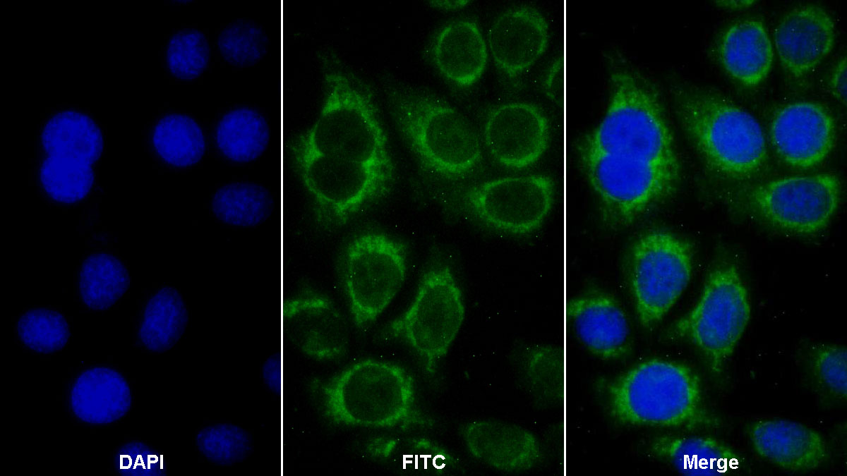 Polyclonal Antibody to Prostate Specific Antigen (PSA)