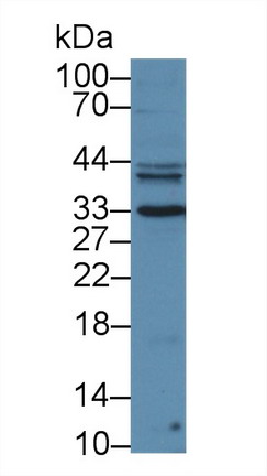 Polyclonal Antibody to Prostate Specific Antigen (PSA)