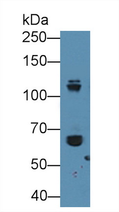 Polyclonal Antibody to Alpha-Fetoprotein (AFP)