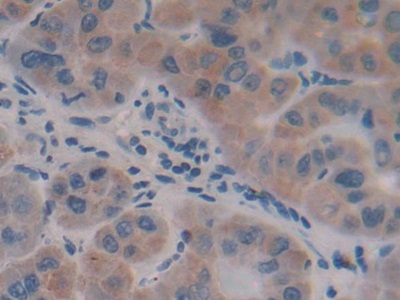 Polyclonal Antibody to Alpha-Fetoprotein (AFP)