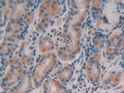 Polyclonal Antibody to Alpha-Fetoprotein (AFP)