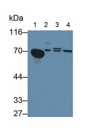 Polyclonal Antibody to Alpha-Fetoprotein (AFP)