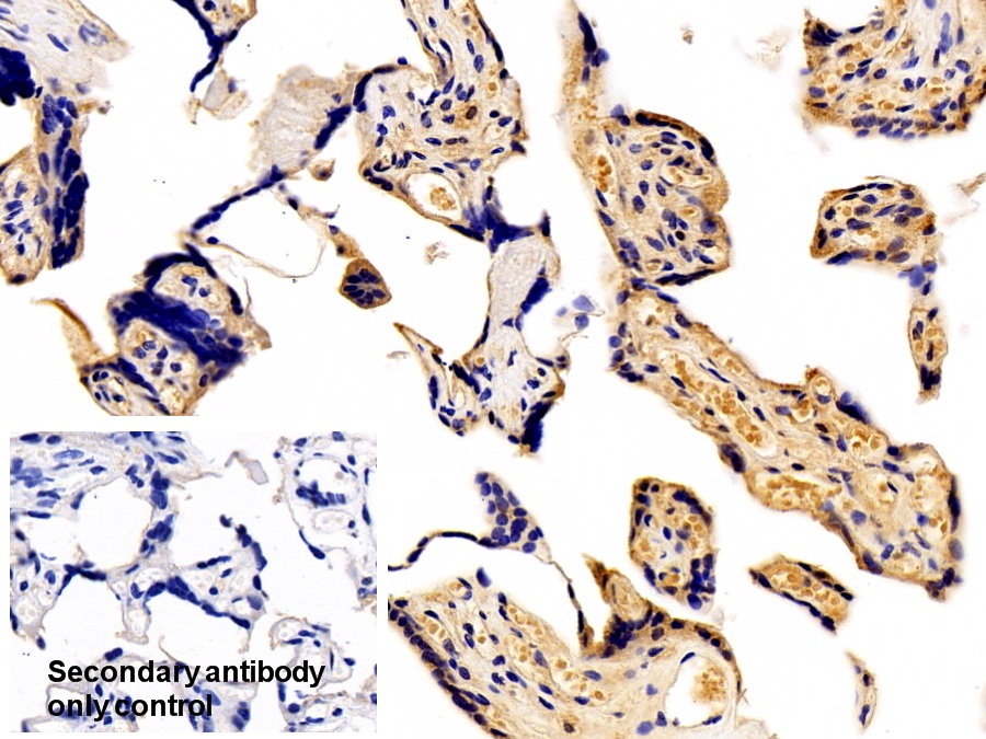 Polyclonal Antibody to Alpha-Fetoprotein (AFP)