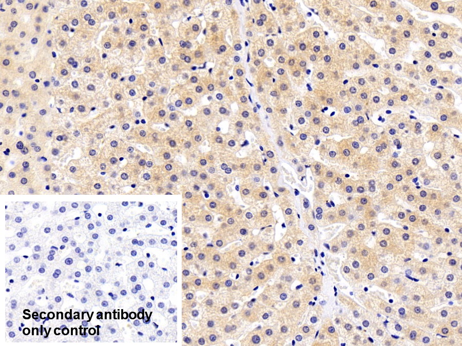 Polyclonal Antibody to Alpha-Fetoprotein (AFP)