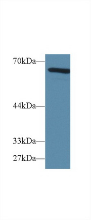 Polyclonal Antibody to Alpha-Fetoprotein (AFP)