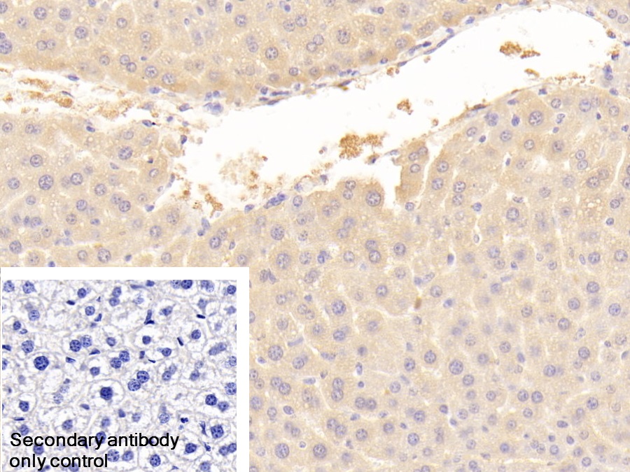 Polyclonal Antibody to Alpha-Fetoprotein (AFP)