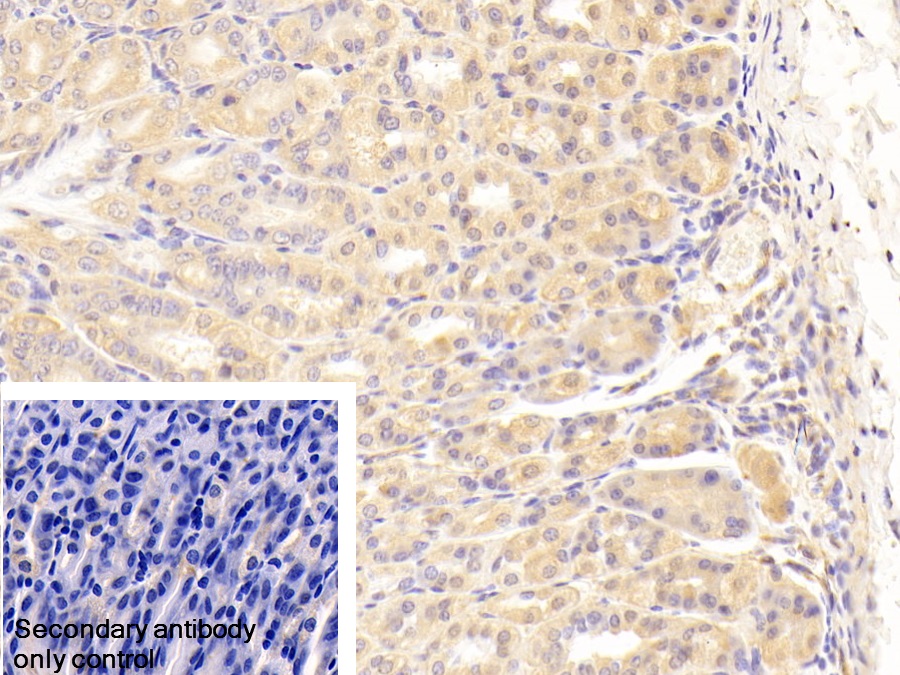 Polyclonal Antibody to Alpha-Fetoprotein (AFP)