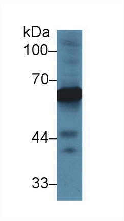 Polyclonal Antibody to Alpha-Fetoprotein (AFP)