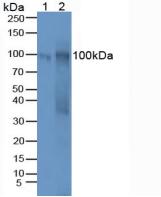 Polyclonal Antibody to Carbohydrate Antigen 125 (CA125)