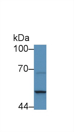 Polyclonal Antibody to Serpin Peptidase Inhibitor,Clade B,Member 4 (SERPINB4)