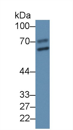 Polyclonal Antibody to Alpha 2-Antiplasmin (a2PI)