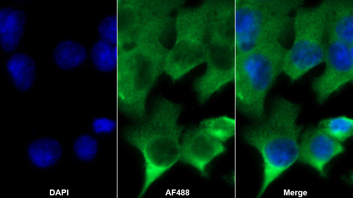 Polyclonal Antibody to Alpha 2-Antiplasmin (a2PI)