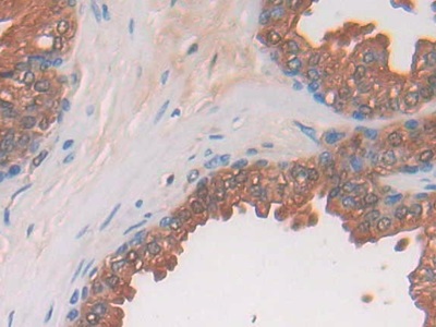 Polyclonal Antibody to Prostatic Acid Phosphatase (PAP)