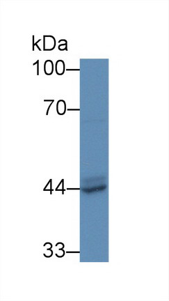 Polyclonal Antibody to Prostatic Acid Phosphatase (PAP)