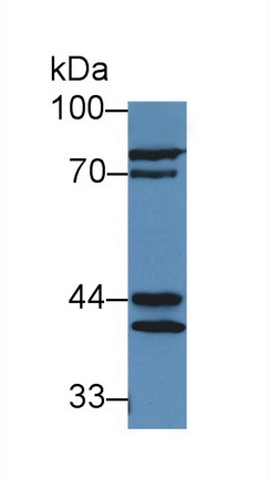 Polyclonal Antibody to Prostatic Acid Phosphatase (PAP)