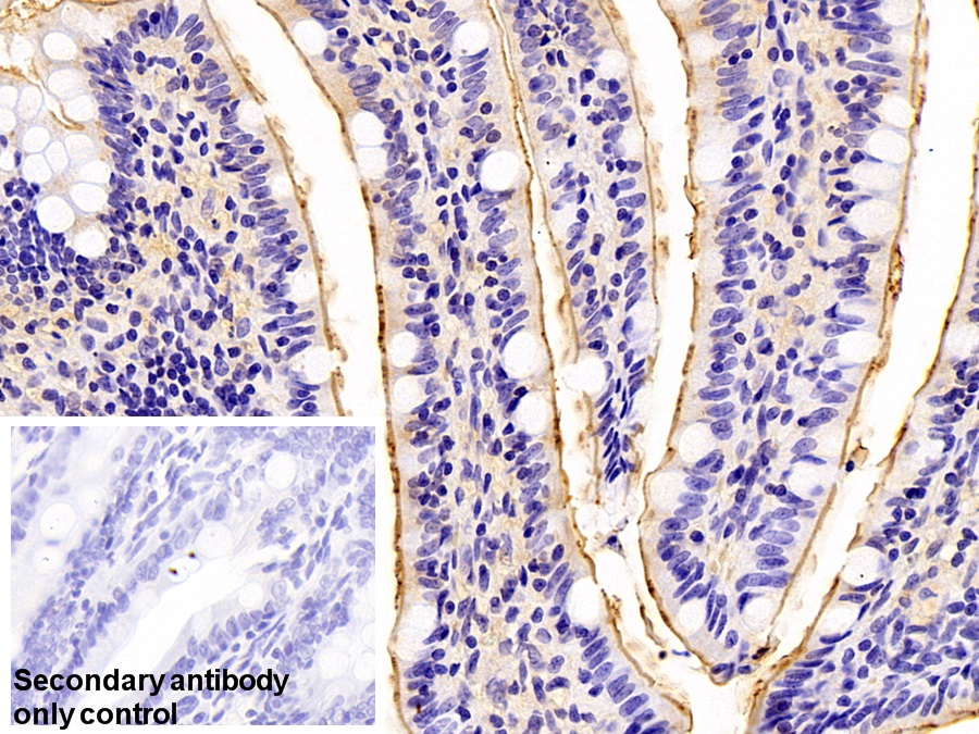 Polyclonal Antibody to Meprin A Alpha (MEP1a)