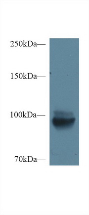 Polyclonal Antibody to Meprin A Alpha (MEP1a)