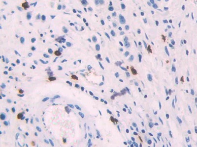 Polyclonal Antibody to Platelet Factor 4 (PF4)