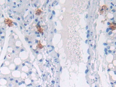 Polyclonal Antibody to Glucosidase Alpha, Acid (GaA)