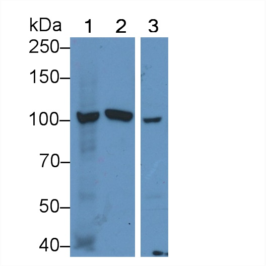 Polyclonal Antibody to Glucosidase Alpha, Acid (GaA)