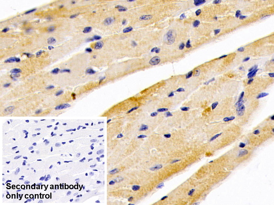 Polyclonal Antibody to Glucosidase Alpha, Acid (GaA)