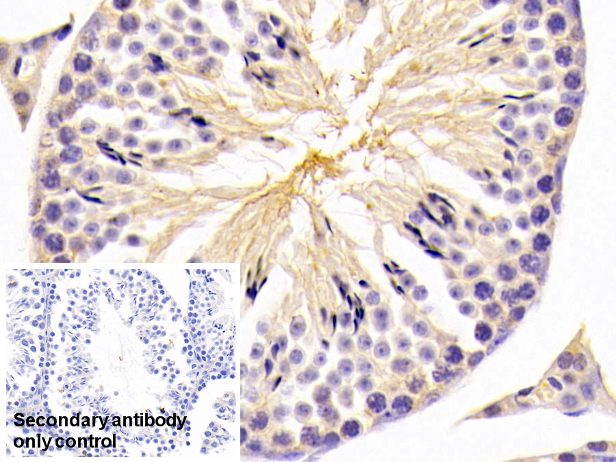 Polyclonal Antibody to Glucosidase Alpha, Acid (GaA)