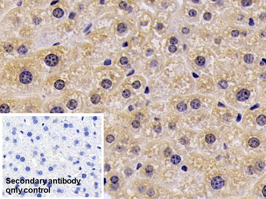 Polyclonal Antibody to Glucosidase Alpha, Acid (GaA)