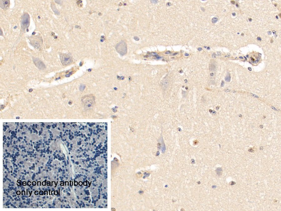 Polyclonal Antibody to Alpha-2-Heremans Schmid Glycoprotein (AHSG)