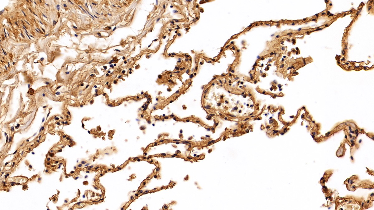 Polyclonal Antibody to Alpha-2-Heremans Schmid Glycoprotein (AHSG)