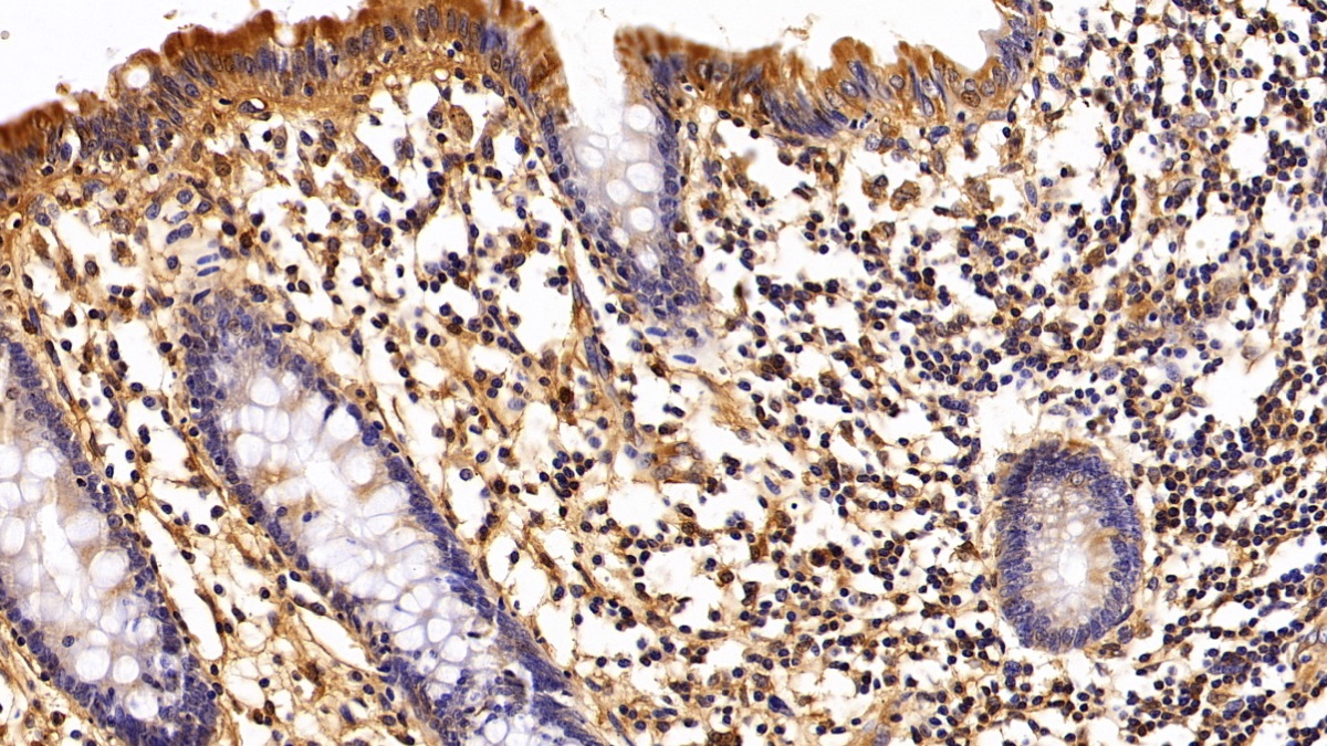 Polyclonal Antibody to Alpha-2-Heremans Schmid Glycoprotein (AHSG)