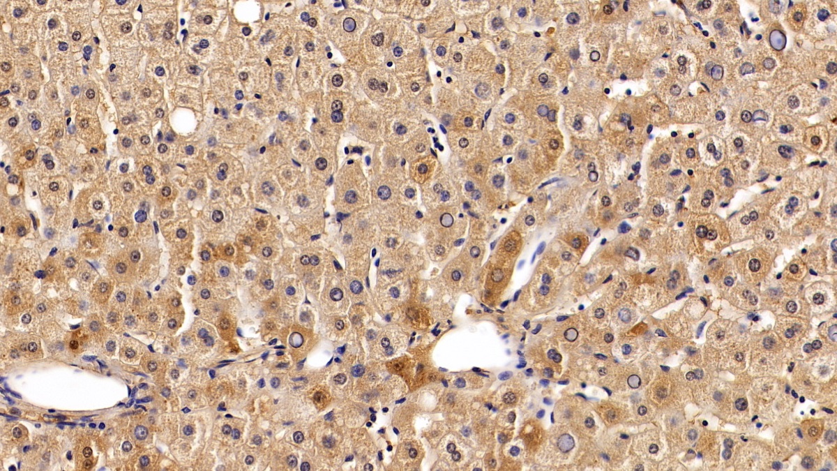 Polyclonal Antibody to Alpha-2-Heremans Schmid Glycoprotein (AHSG)