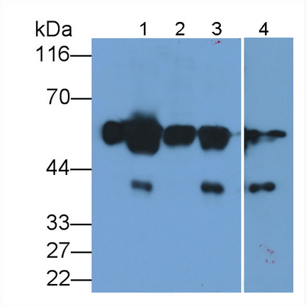 Polyclonal Antibody to Alpha-2-Heremans Schmid Glycoprotein (AHSG)